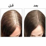 استیک پوشاننده موهای سفید گلدن رز - تصویر 3