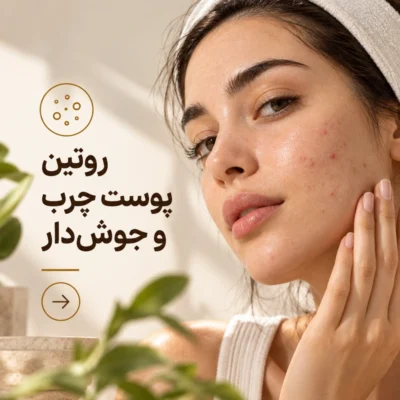 aisanstore oily acne routine 800x800 1